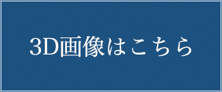 3D画像